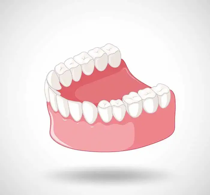 توضیحاتی در رابطه با دندان های پونتیک